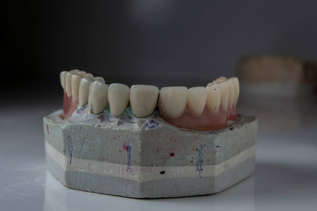 Un’arcata completa in ceramica montata sul modello
