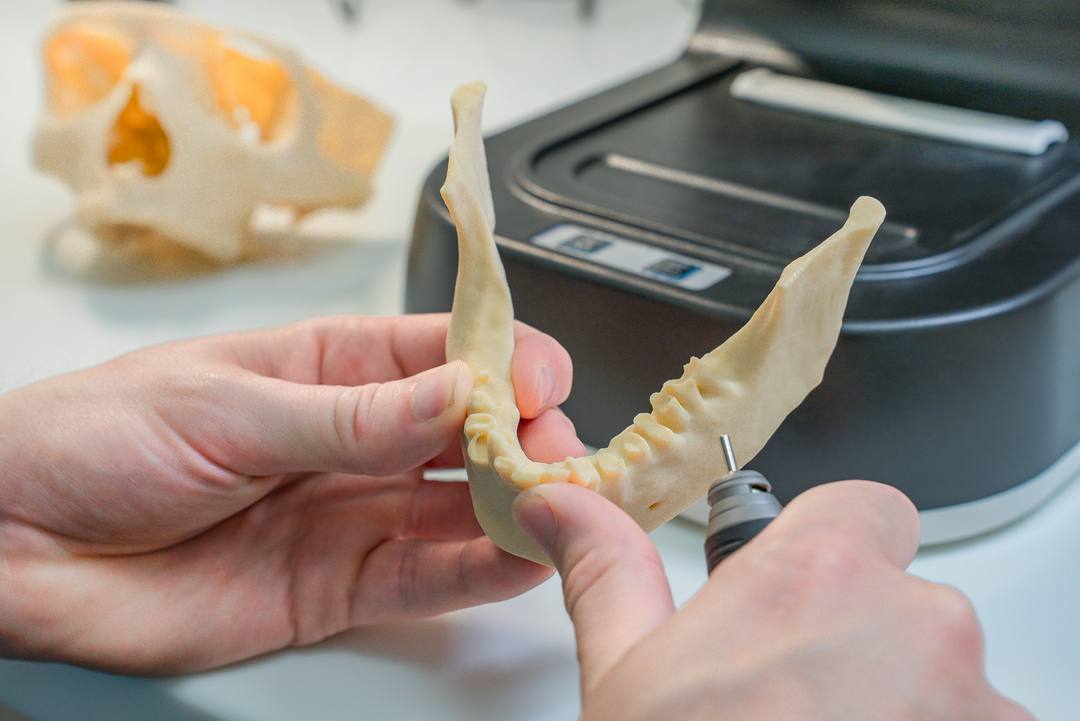 Due mani tengono un modello di mandibola appena stampato in resina