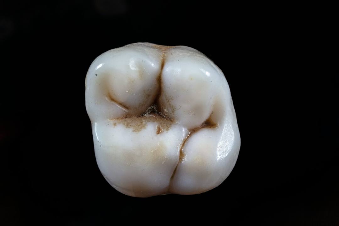La superficie occlusale di un molare in ceramica: cuspidi, creste e solchi