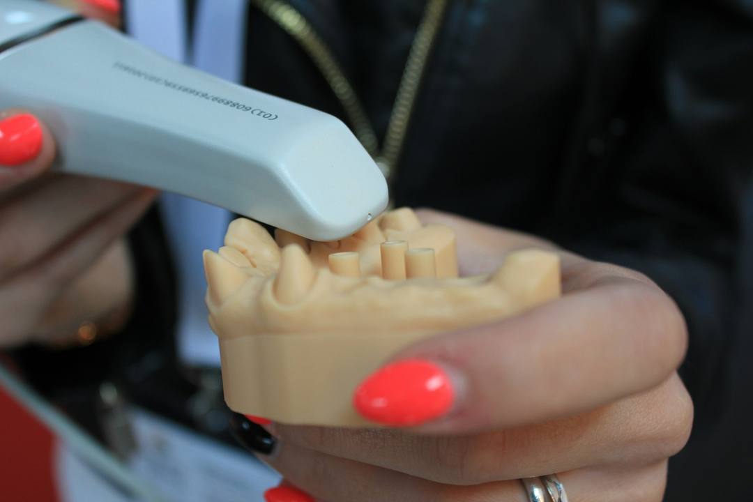 Uno scanner intraorale appoggiato a un modello in gesso